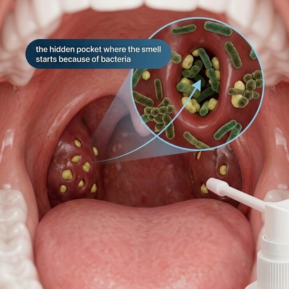 Tonsil Stone Spray — Reach & Clean Hidden Bacteria